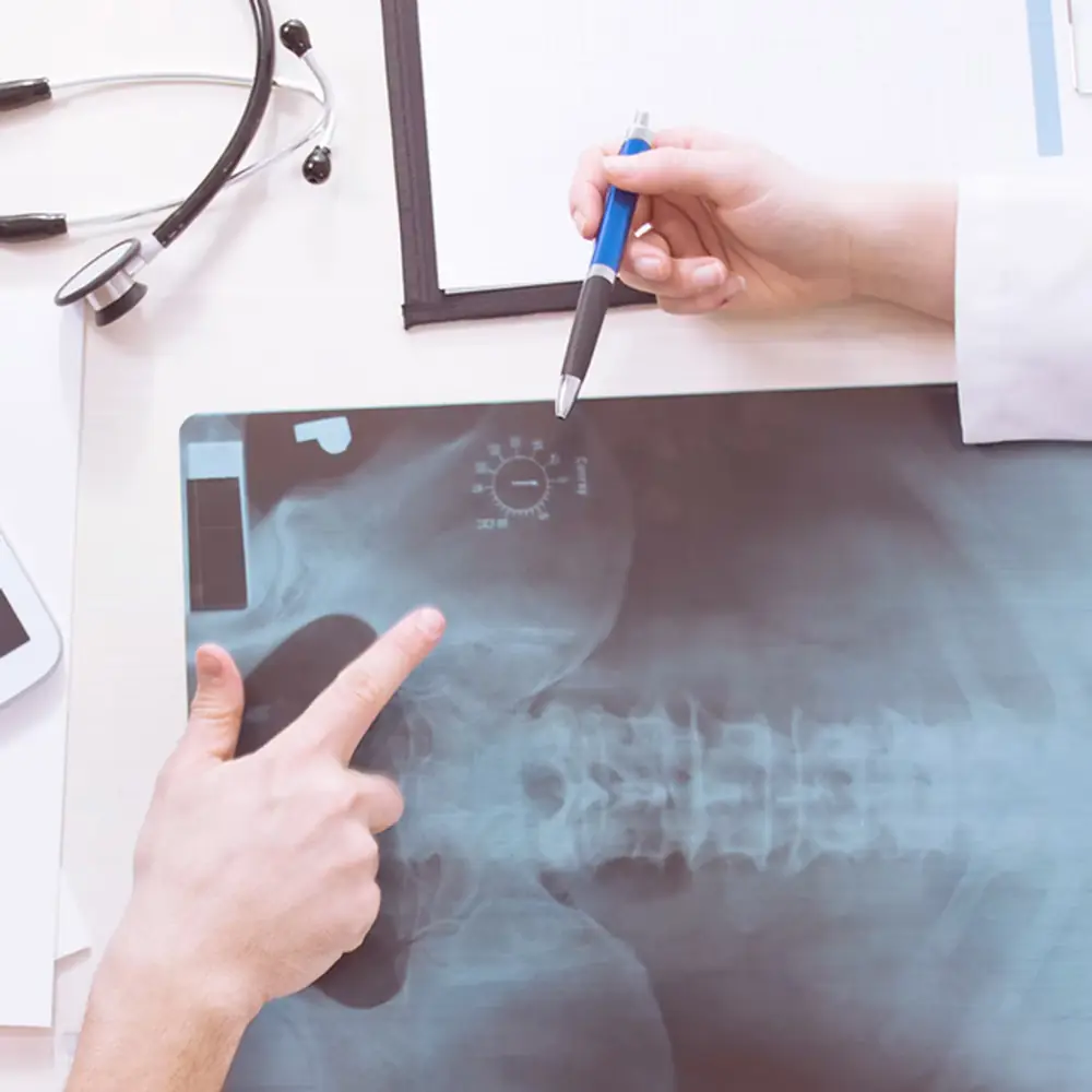 A doctor pointing out features on a spine X-ray